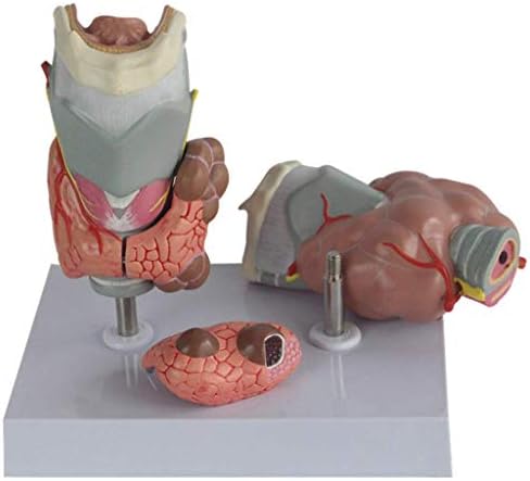 RRGJ Oktatási Modell, 10 Emberi Anatómia Modell Pajzsmirigy Patológia Modell Endokrin Betegség Kijelző